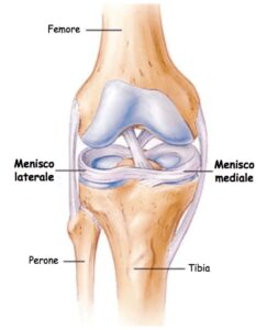 menisco
